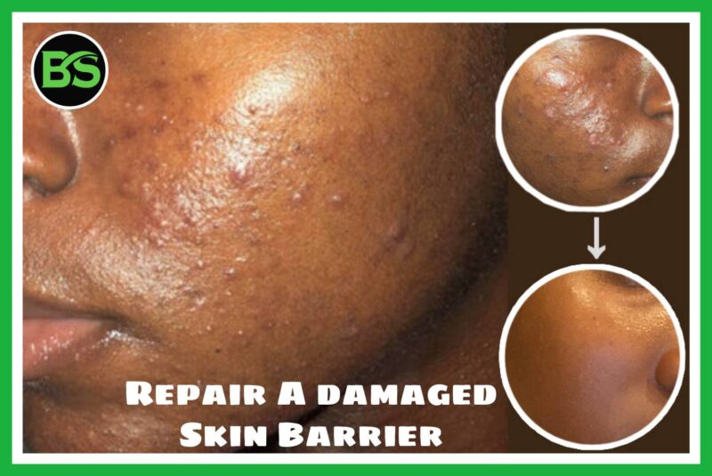 Damaged Skin Barrier repair