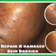 Damaged Skin Barrier repair